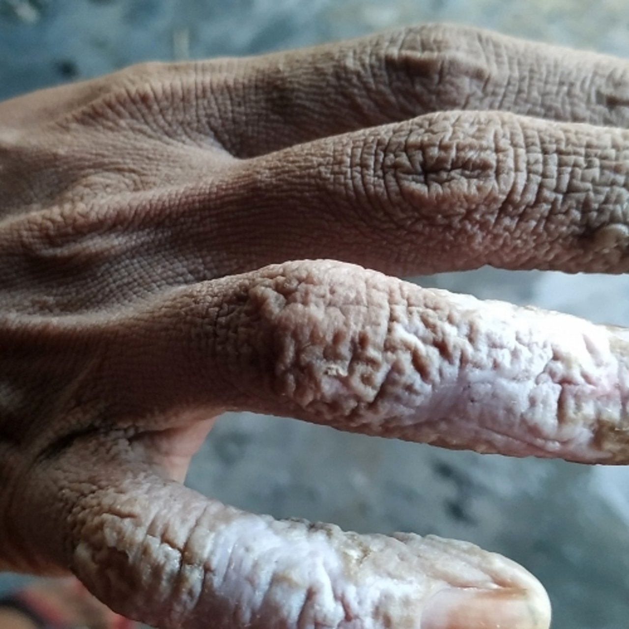 2019 09 BAN Sericulture Hand of a bonded labourer